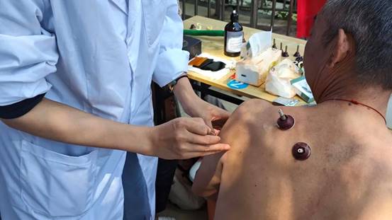 说明:6图为带队老师为居民提供针灸治疗.jpg